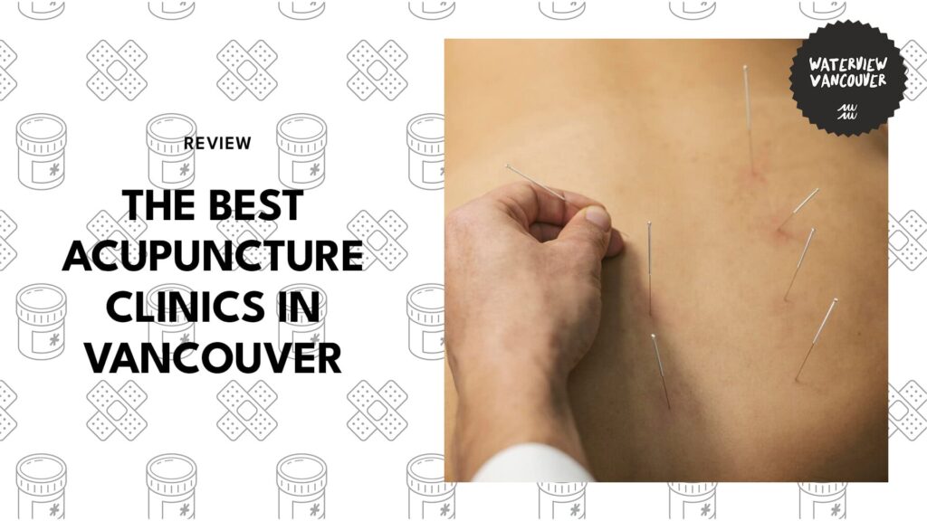 Experience Relief with the Best Acupuncture Clinics in Vancouver