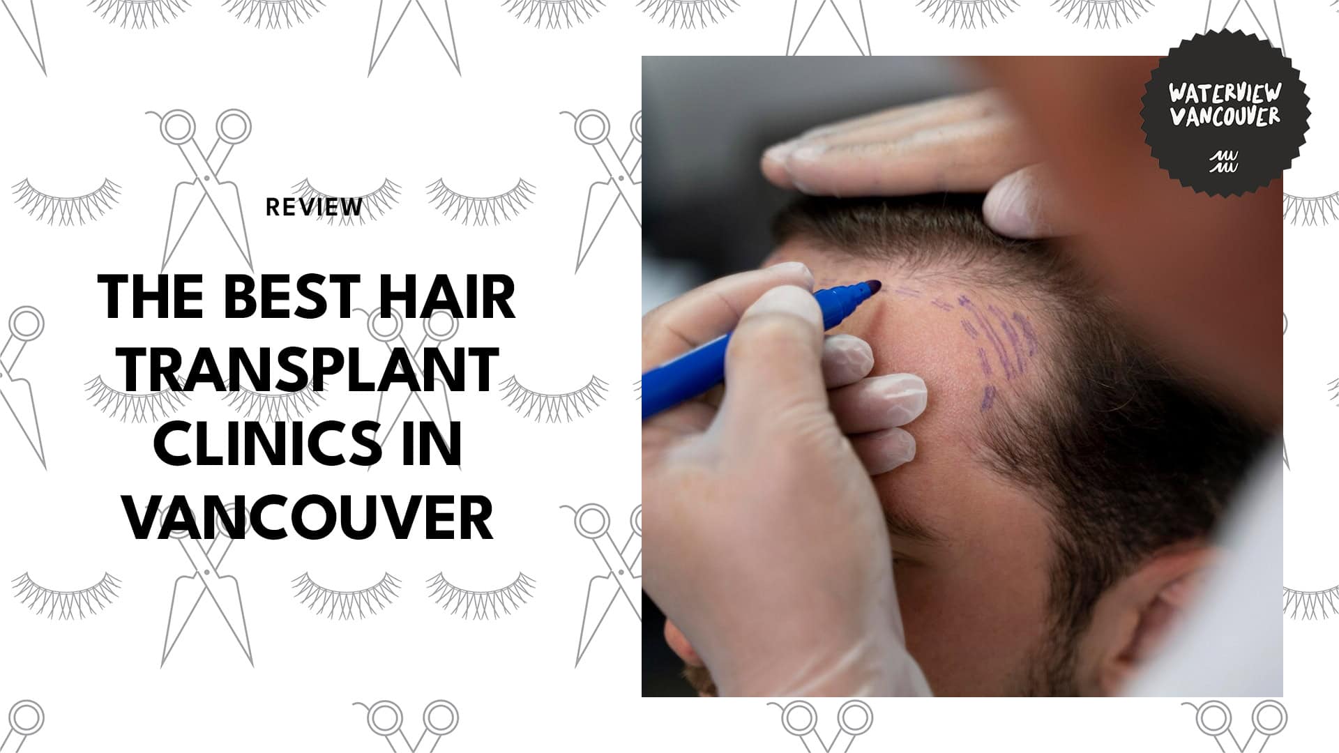 hair-transplant-clinics-in-vancouver