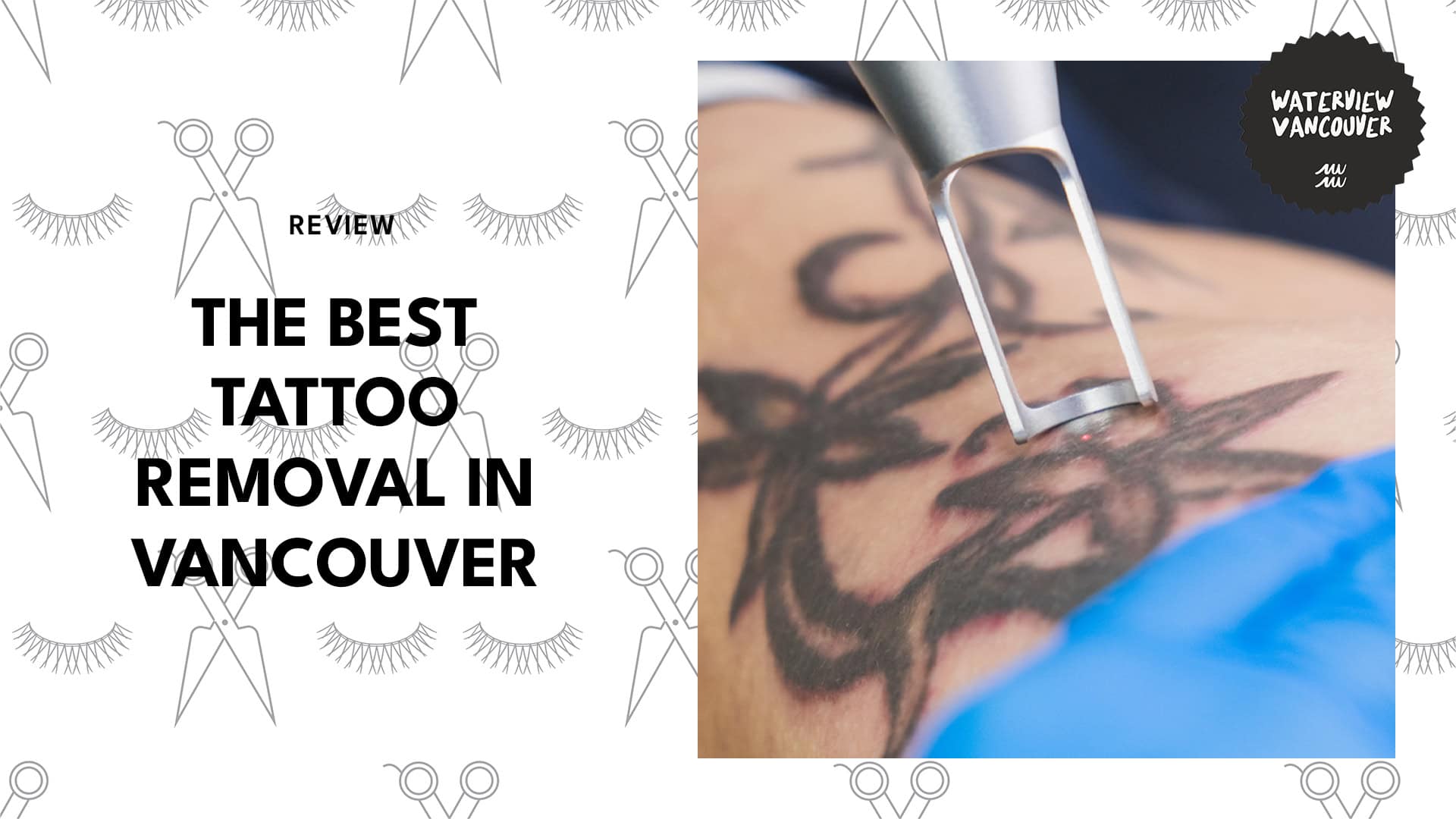 tattoo-removal-in-vancouver