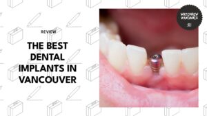 dental-implants-in-vancouver