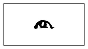 pacific-laser-eye-centre