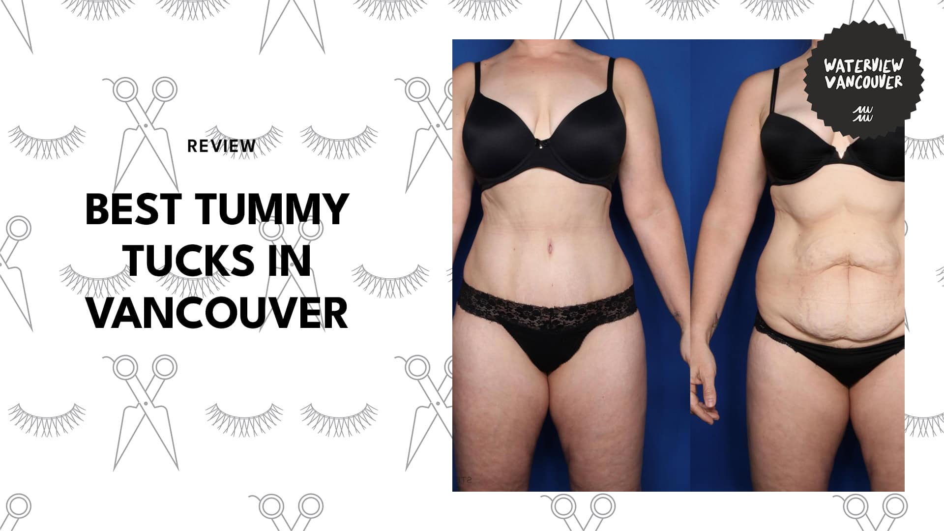 tummy-tucks-in-vancouver