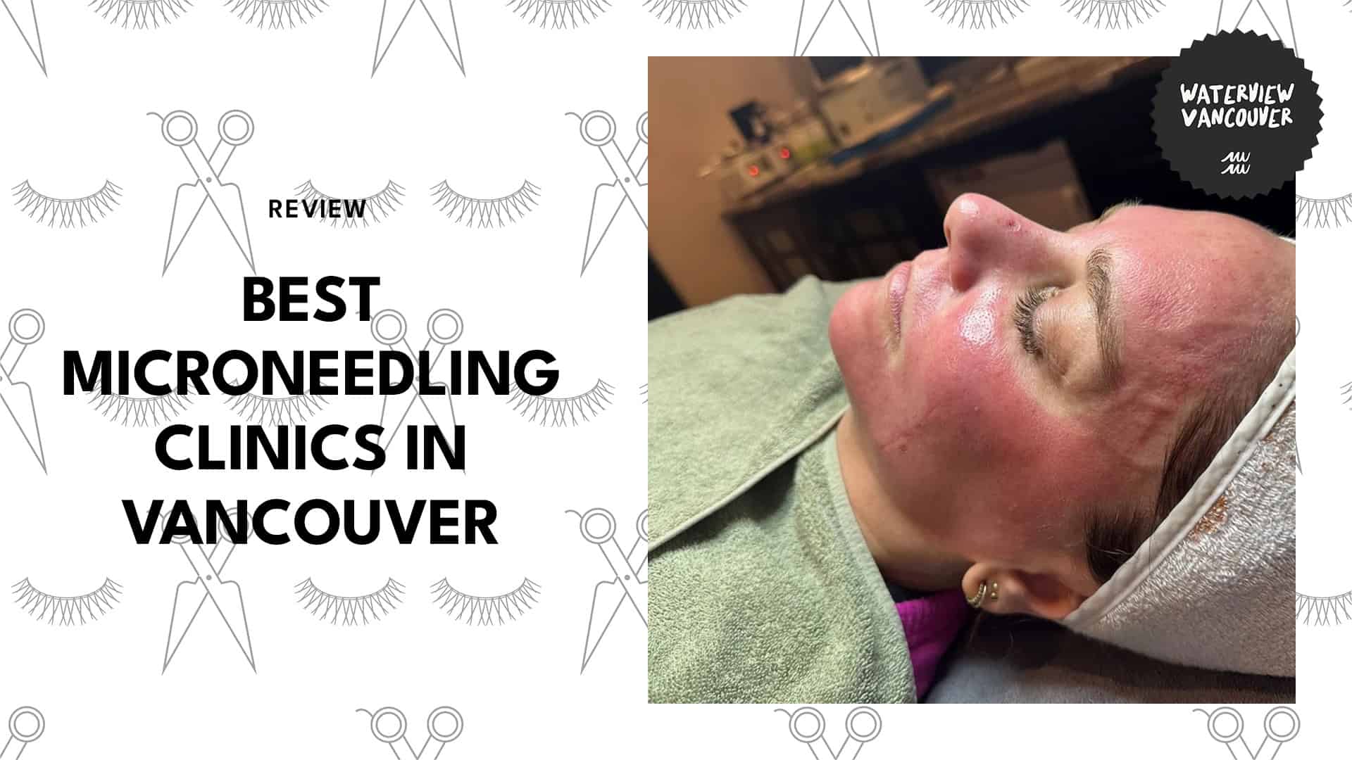 microneedling-clinics-in-vancouver