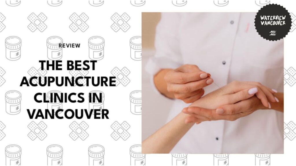 Experience Relief with the Best Acupuncture Clinics in Vancouver