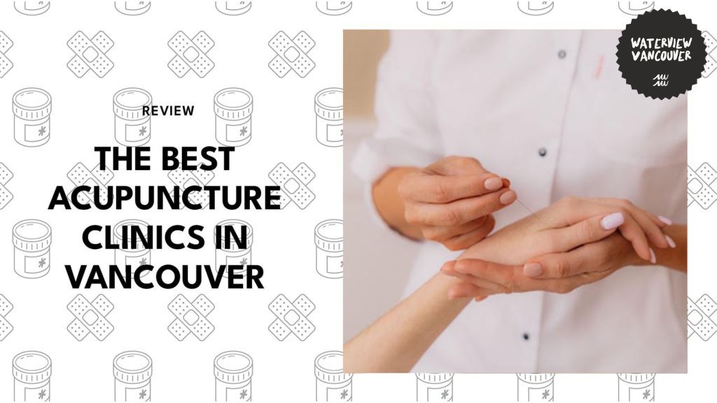 Experience Relief with the Best Acupuncture Clinics in Vancouver